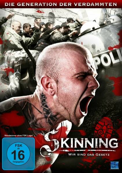 Skinning - Wir sind das Gesetz, DVD